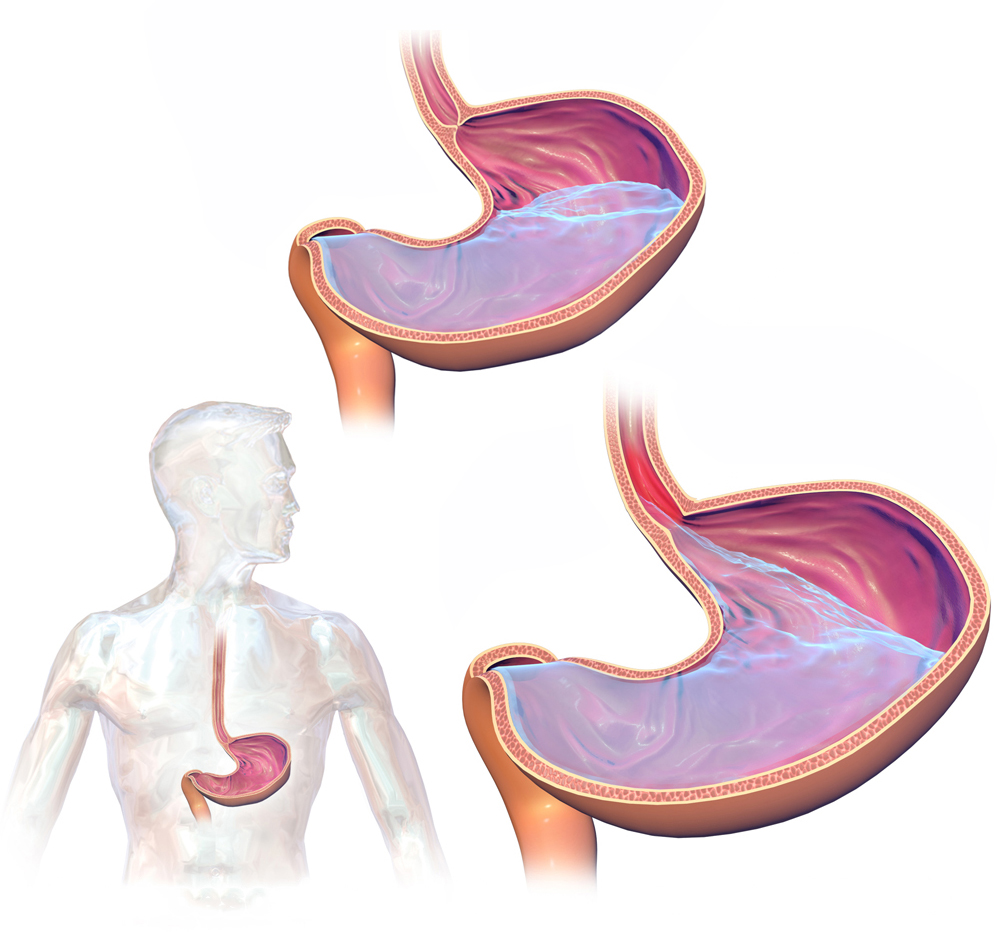 Afbeeldingsresultaat voor maagklepje tips reflux